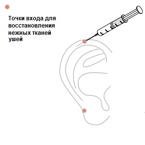 Восстановление мягких тканей ушей с помощью Feature Builder, рисунок 3, бальзамирование и подготовка к прощанию истощенных тел, Tanatoservice