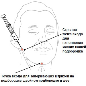 Восстановление мягких тканей подбородка с помощью Feature Builder, рисунок 7, бальзамирование и подготовка к прощанию истощенных тел, Tanatoservice