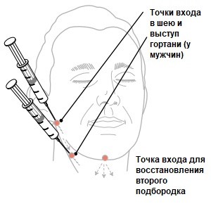 Восстановление мягких тканей шеи с помощью Feature Builder, рисунок 8, бальзамирование и подготовка к прощанию истощенных тел, Tanatoservice